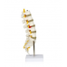 Lumbar Spinal Column with Sacral